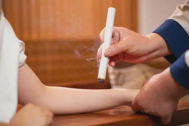 艾灸和拔罐的注意事項！